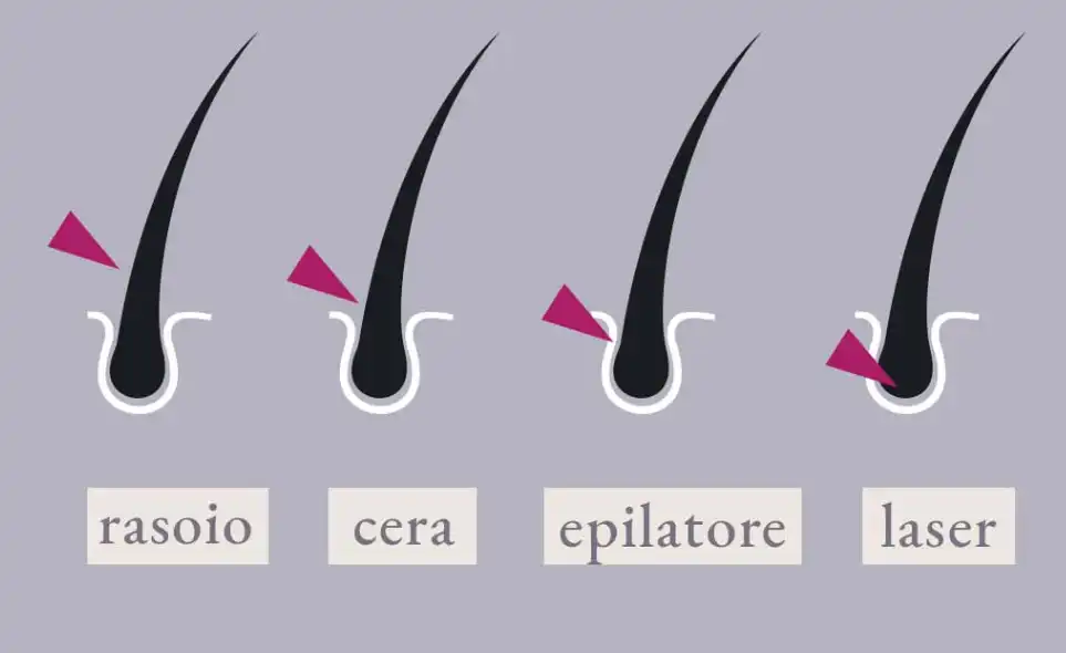 azione laser confronto